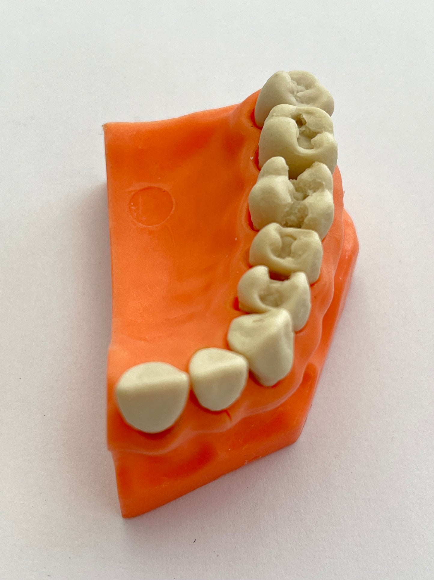 Hemiarcada tipodonto 1/4 de arcada con cavidades
