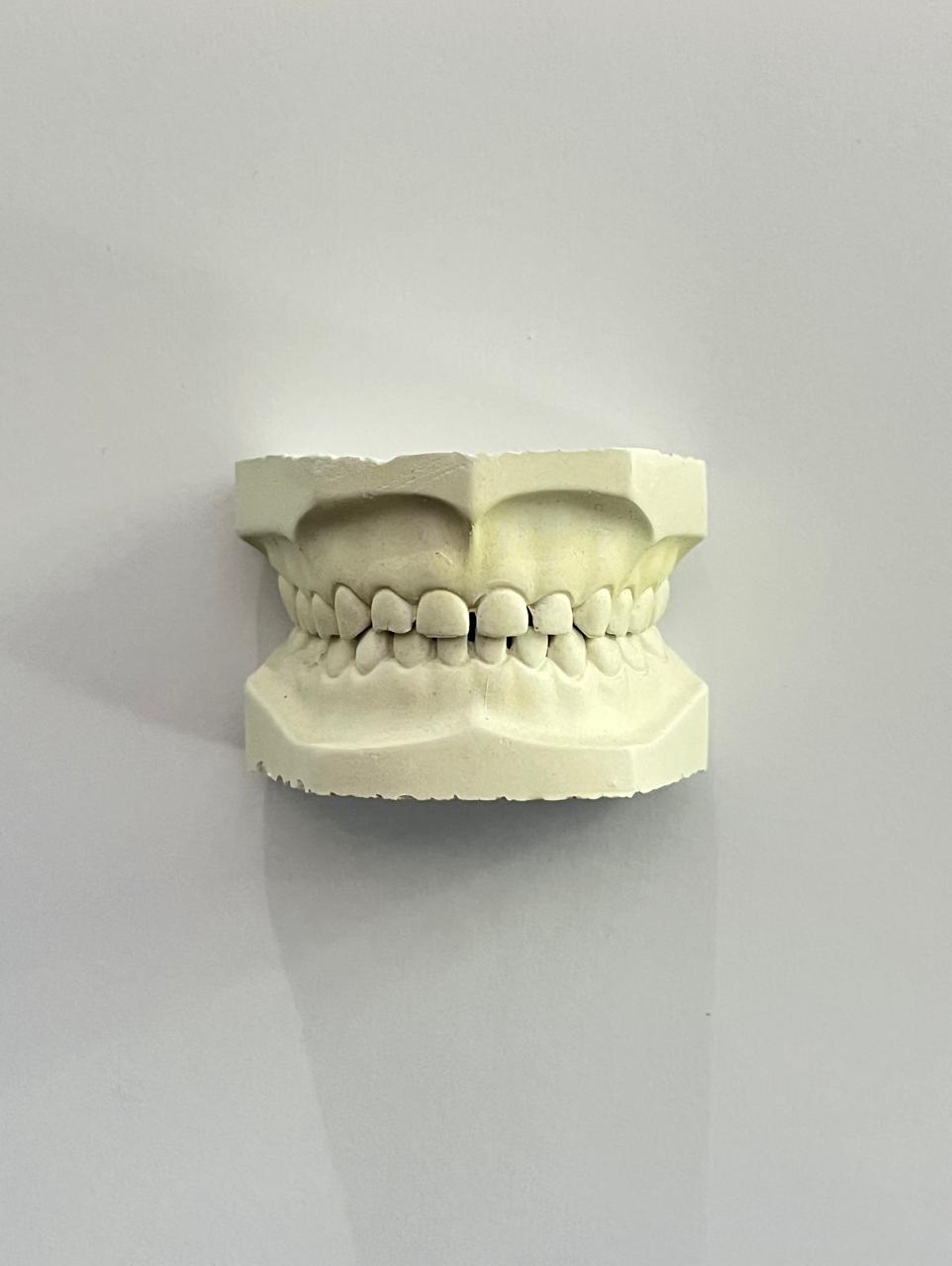 Tipodonto Modelo de yeso infantil steel dental