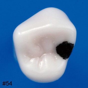 Nissin Modelo de Diente Endodóntico Pediátrico SERIE A12A pieza pulpa caries #54