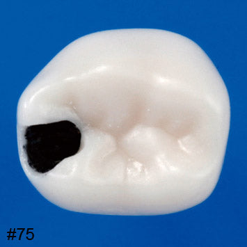 Nissin Modelo de Diente Endodóntico Pediátrico SERIE A12A pieza pulpa caries #75