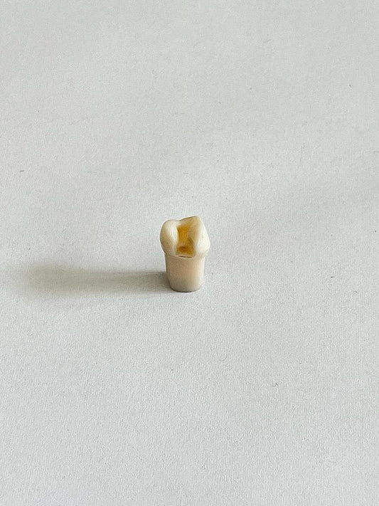 Diente con preparación nissin Clase II UL44