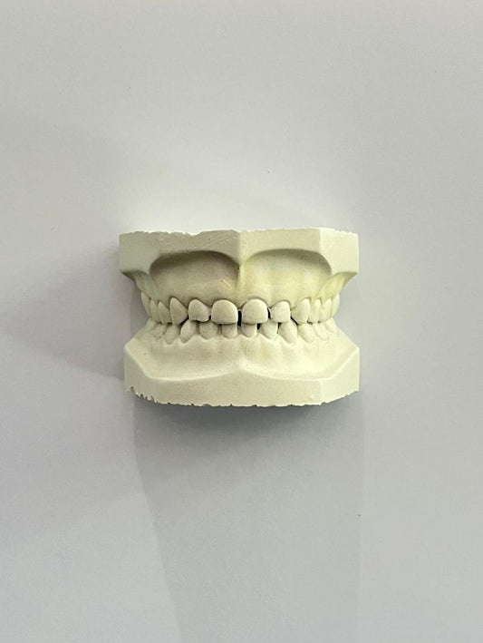 Tipodonto Modelo de yeso infantil steel dental