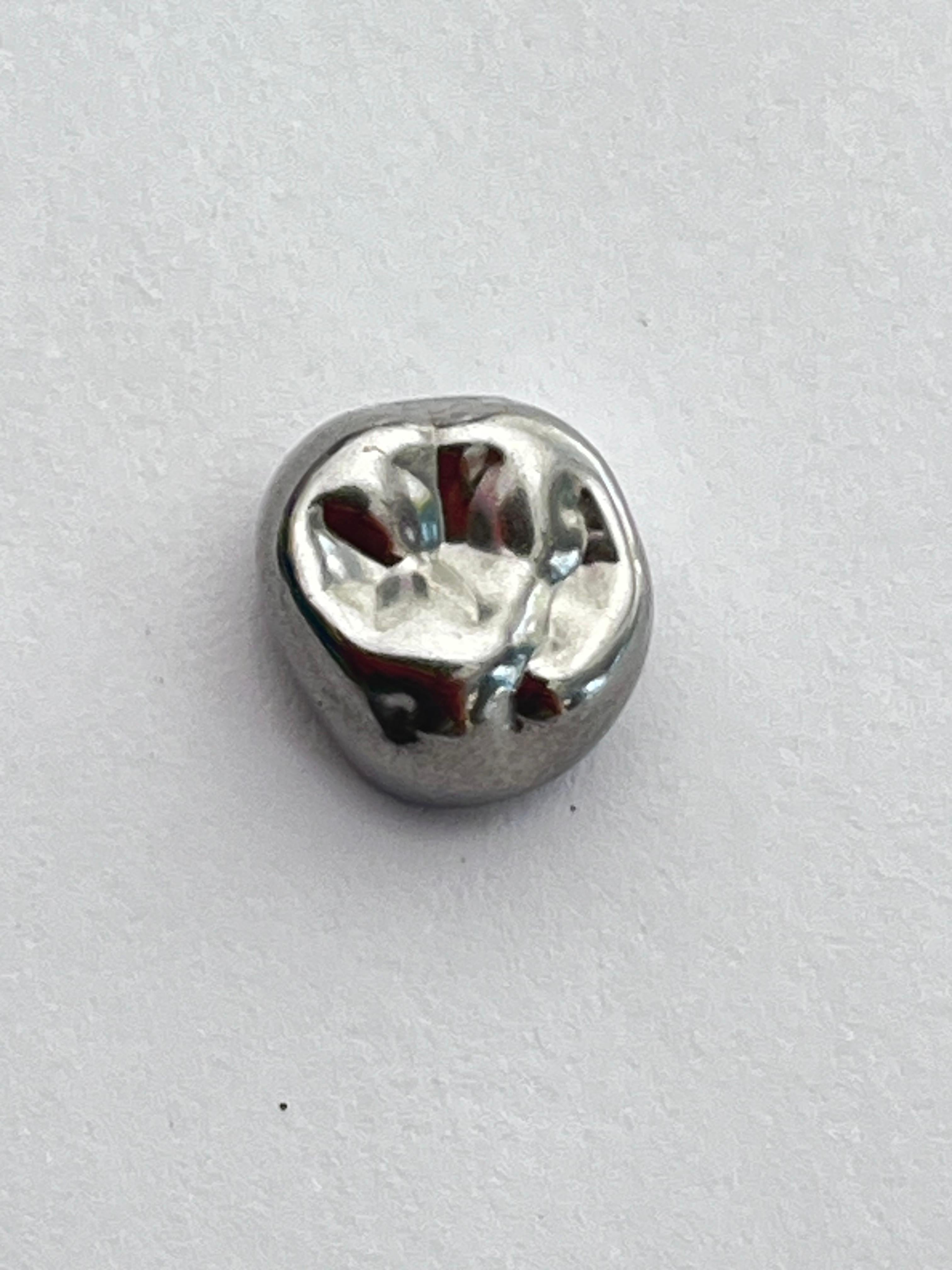 Corona posterior 3M acero cromo EUL2 superior izquierda segundo molar temporal