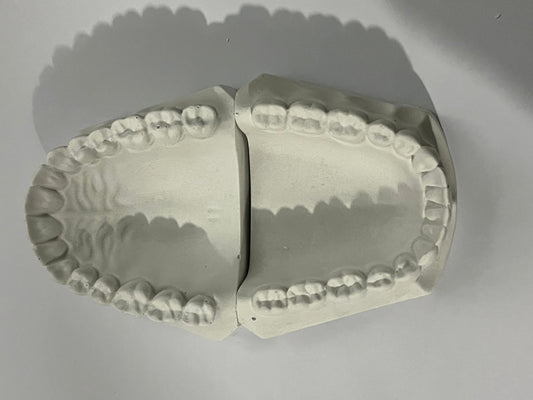 Tipodonto Modelo de yeso dentado